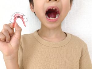 小児矯正のイメージ