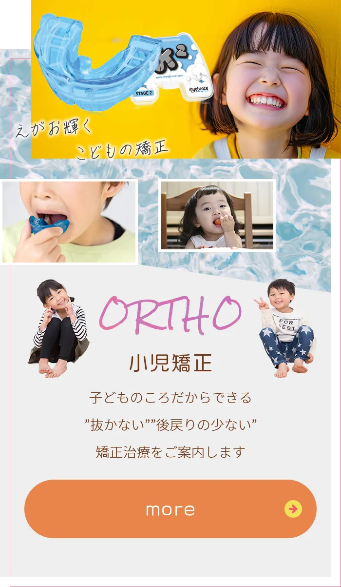 小児矯正｜子どものころだからできる「抜かない」「後戻りの少ない」矯正治療をご案内します