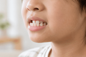 子供の受け口の治療はいつから？原因・年齢別の治し方と費用を解説